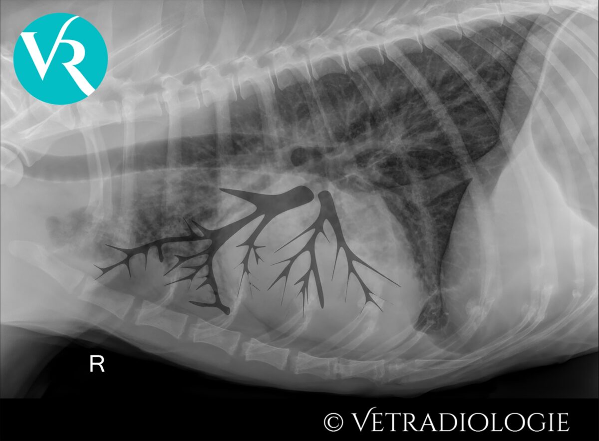 Aerobronchogramme
